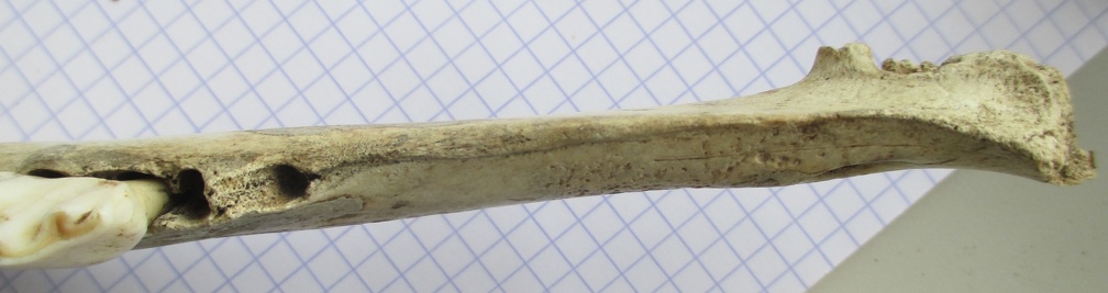 Mand adulte D diastème dors