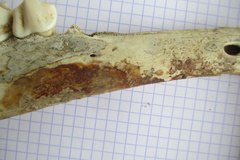 Mand adulte D diastème1