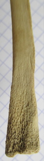 Ulna G dist