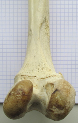 Fémur D dist caud