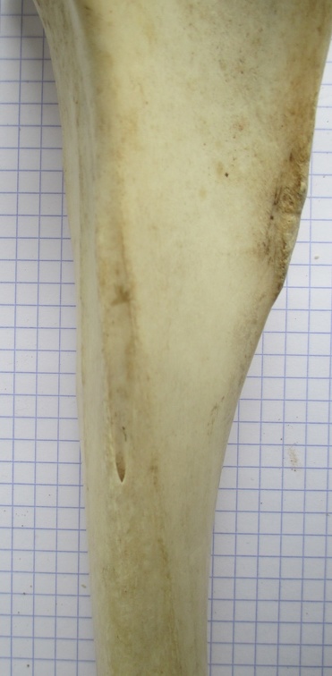 Tibia D diaphyse1
