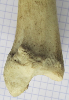Tibia D dist med