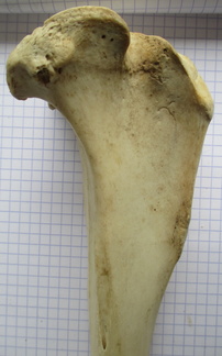 Tibia D prox lat