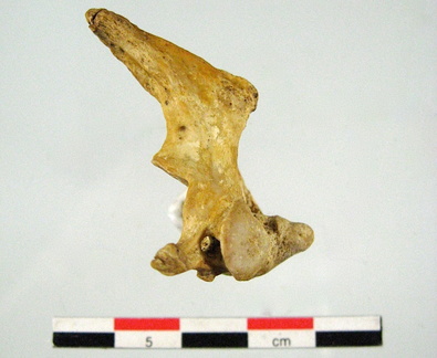 Vertebres cervicales Axis lateral D