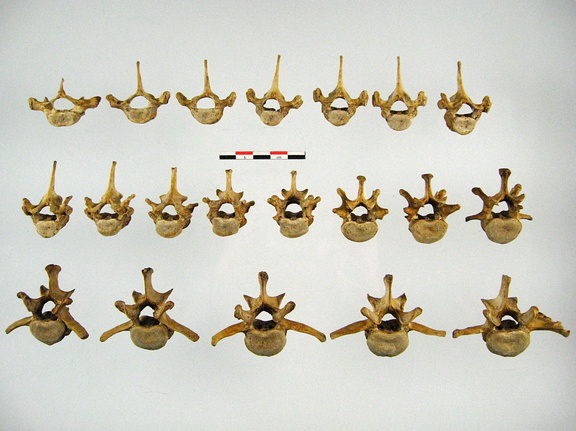 Vertebres thoraciques lombaires anterieur