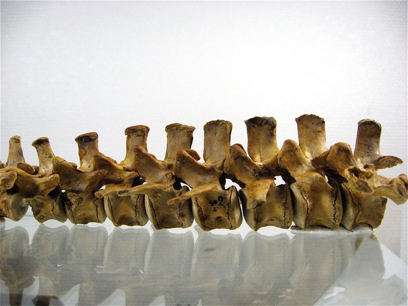 Vertebres_thoraciques_lombaires_lateral_G_01.jpg