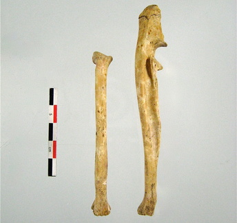 Radius Ulna posterieur