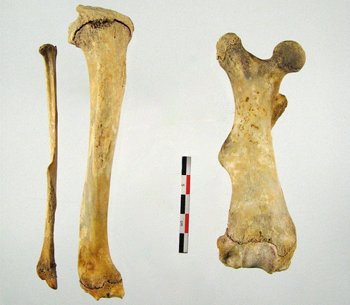 Femur Tibia Fibula
