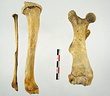 Femur Tibia Fibula