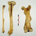 Femur anterieur