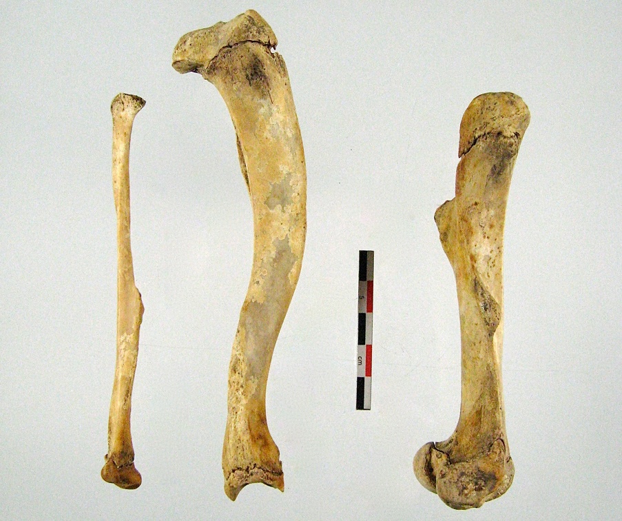 Femur Tibia Fibula mesial