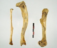 Femur Tibia Fibula mesial