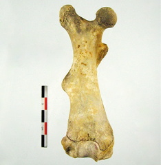 Femur Tibia Fibula posterieur