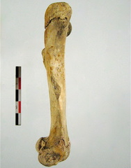 Femur posterieur