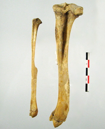 Femur Tibia Fibula lateral