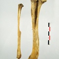 Femur_Tibia_Fibula_lateral.jpg