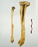 Femur Tibia Fibula lateral