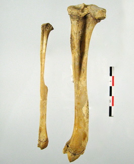 Femur Tibia Fibula lateral