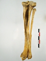 Femur lateral