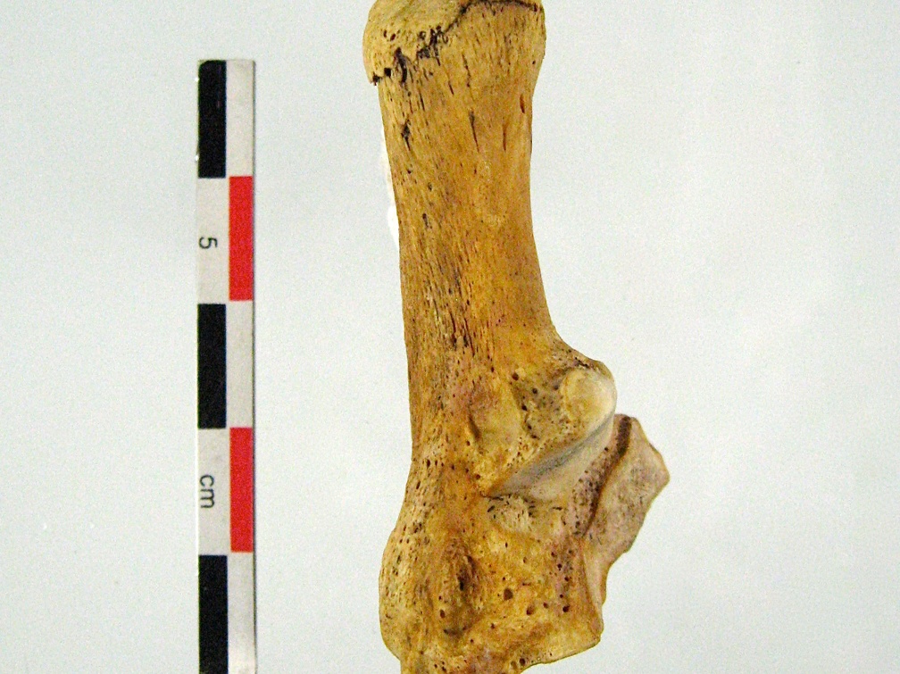 Tarse Calcaneum