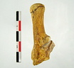 Tarse Calcaneum