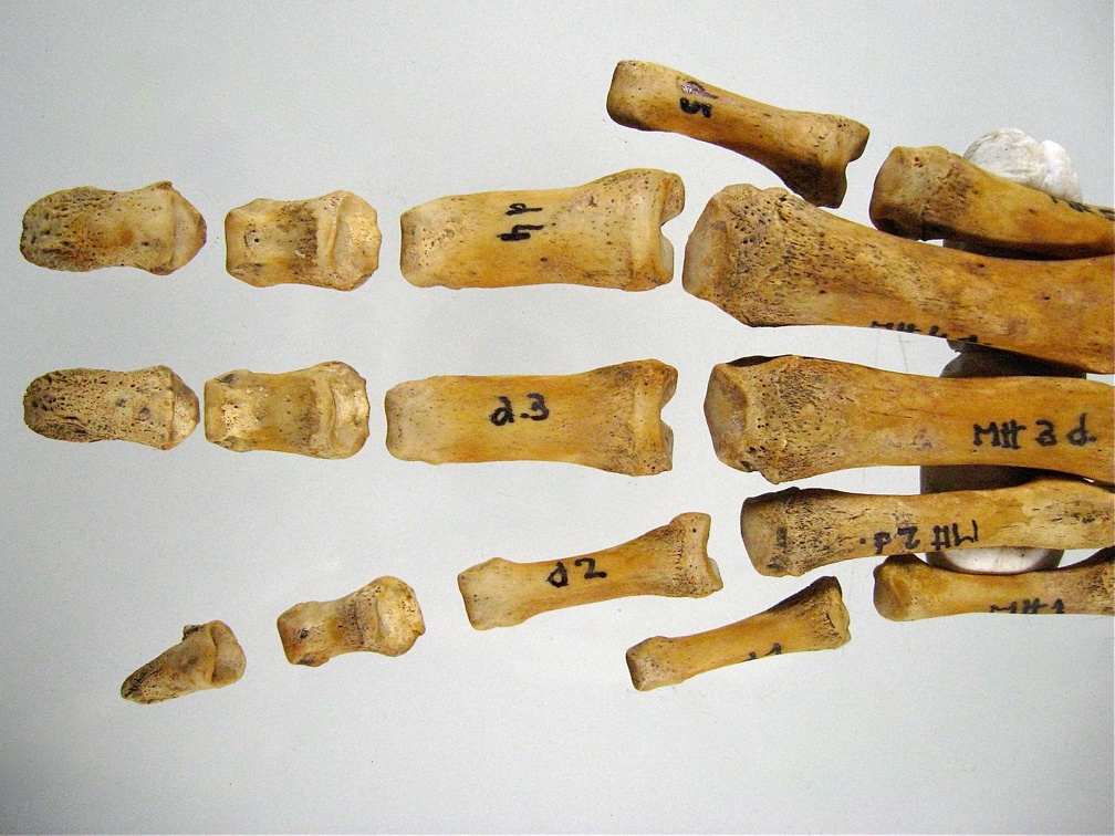 Metatarses Phalanges anterieur 02