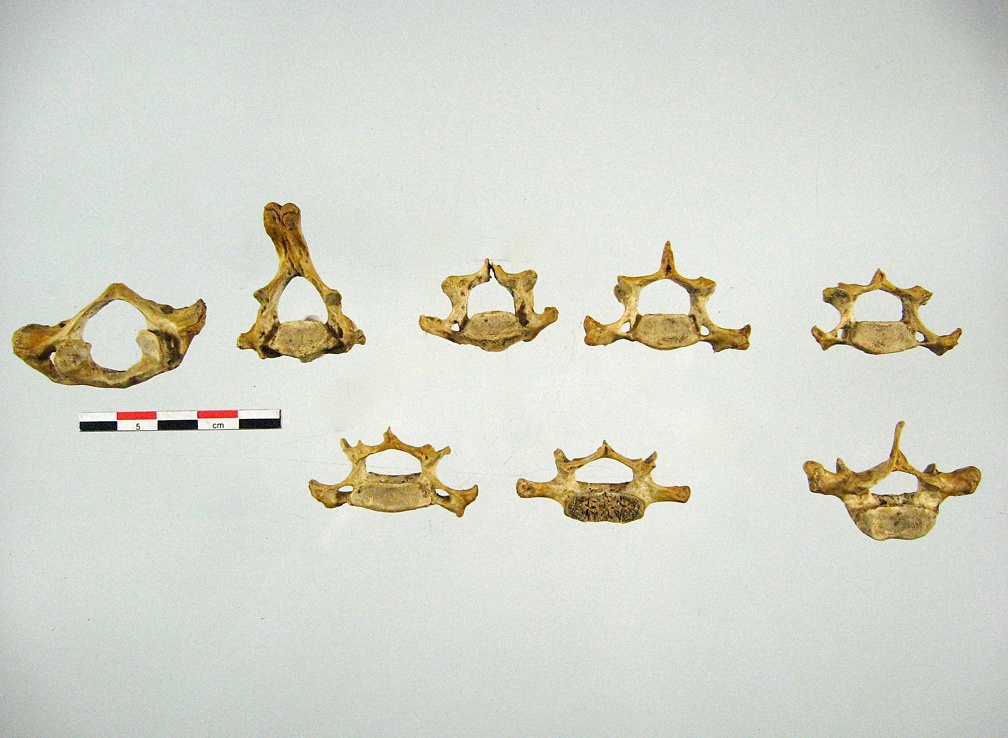 Vertebres cervicales posterieur