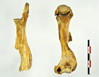 Scapula Humerus lateral