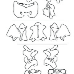 Cervical vertebrae