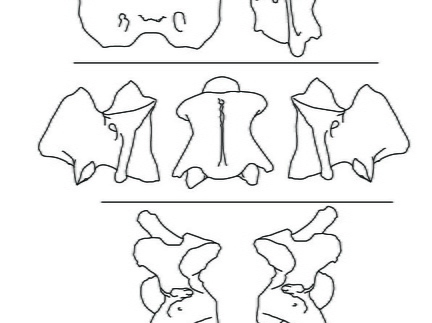 Cervical vertebrae