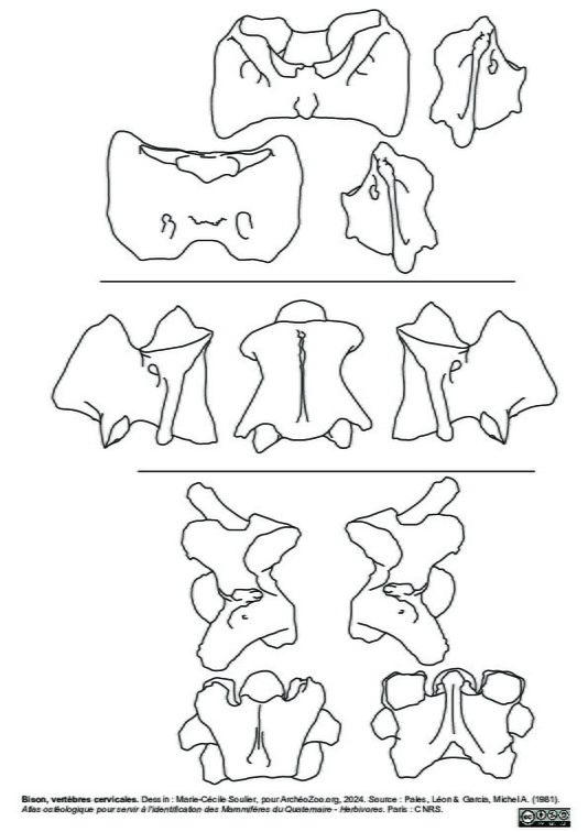 Vertèbres cervicales