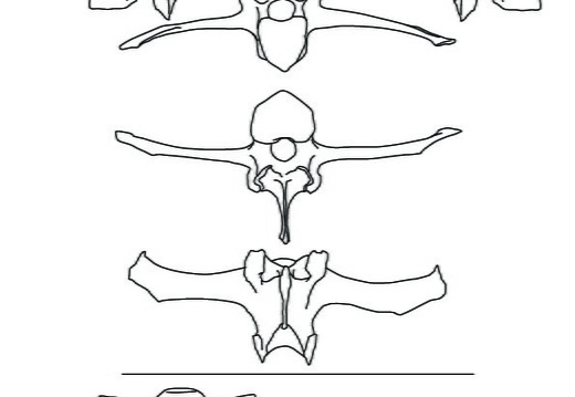 Lumbar vertebrae and sacrum