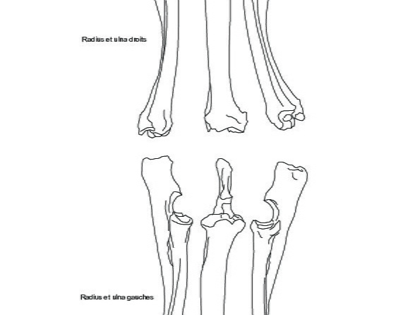 Radius et ulnas